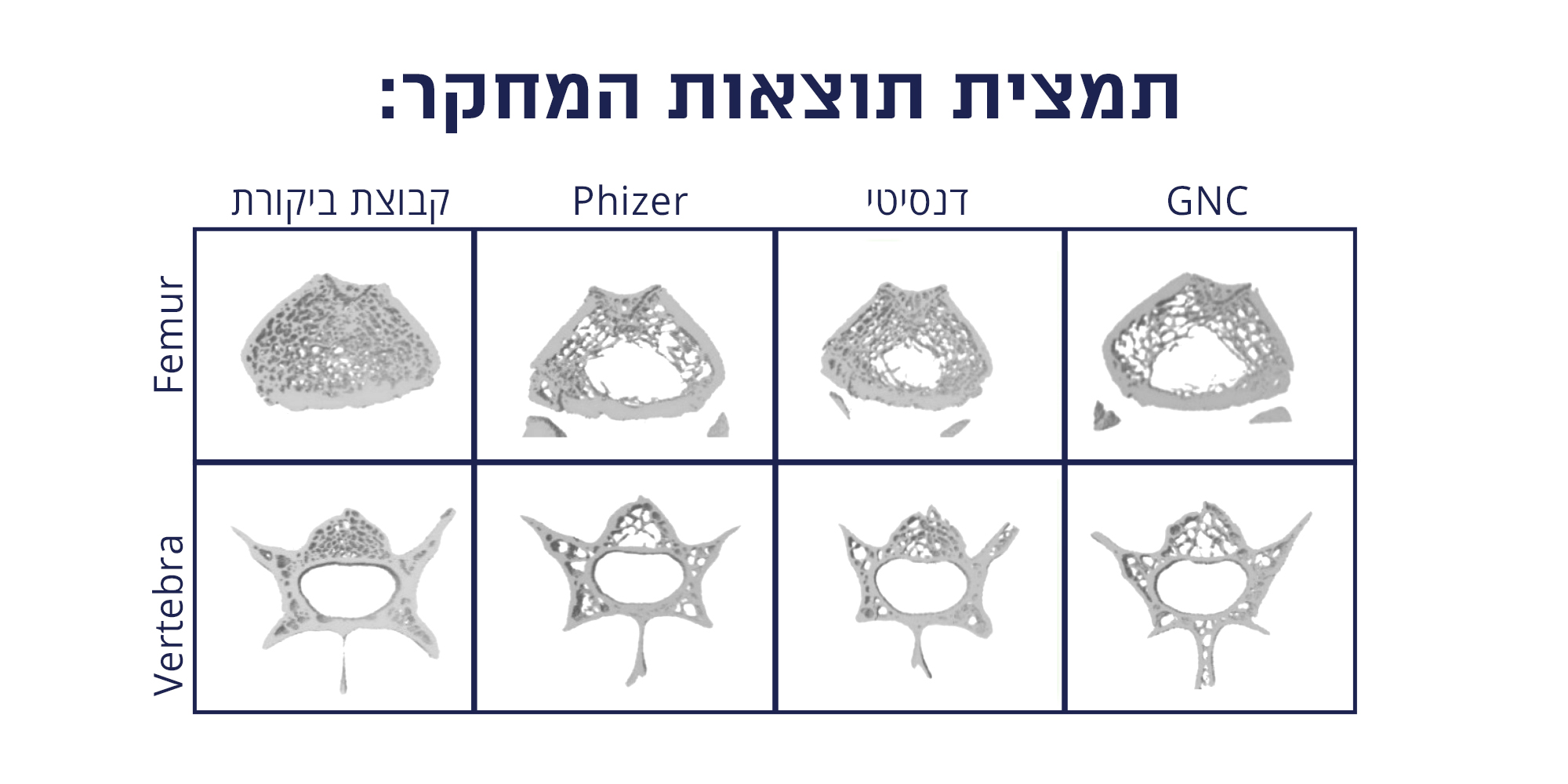 תוצאות מחקר דנסיטי