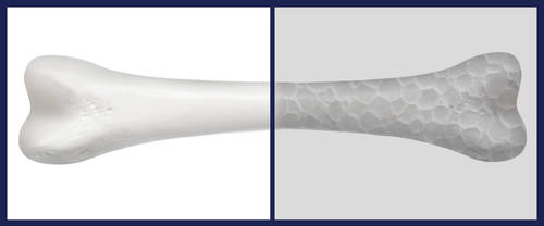 יש סידן ויש דנסיטי 